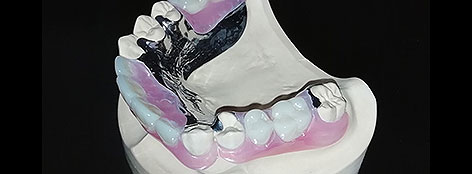 義歯(入れ歯)研究、エビデンス重視の治療