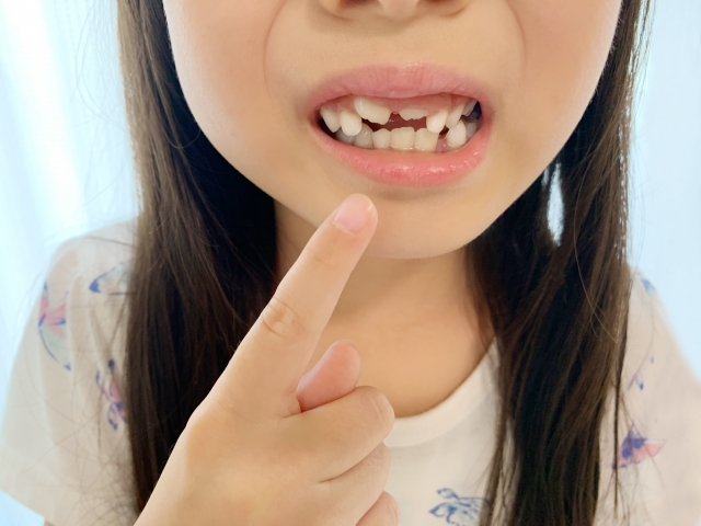 歯並びに悩む子供の写真