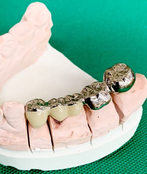 ブリッジの写真