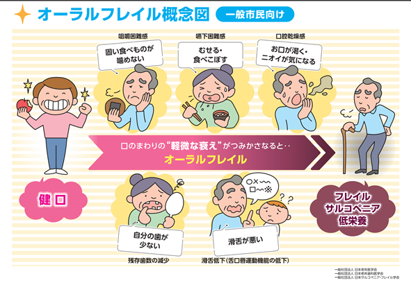 オーラルフレイル概念図